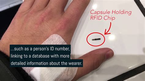 united kindom is rfid chipping their citizens|Fear, Uncertainty, and Doubt about Human Microchips.